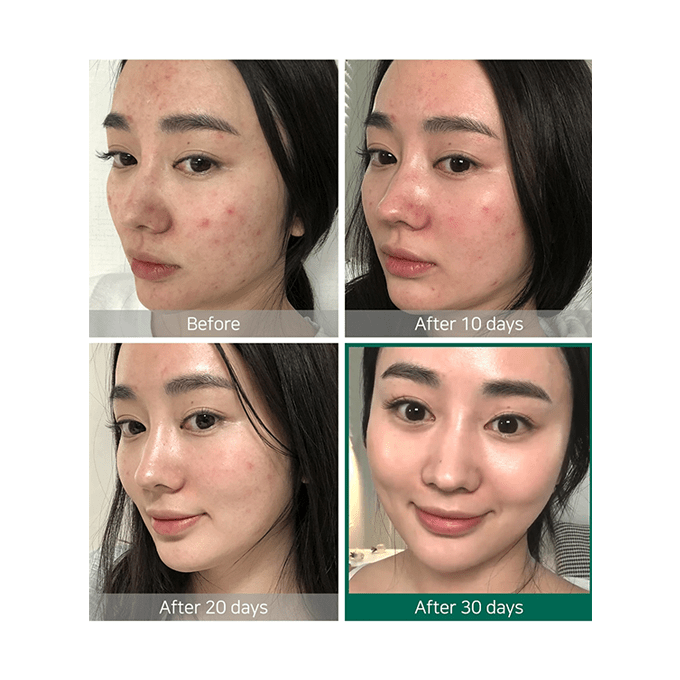 Some By Mi 30 Days Miracle Toner with AHA, BHA, and PHA - 150ml